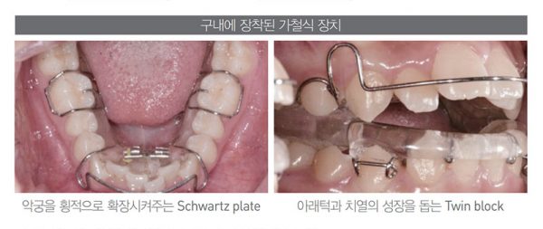 dental_003